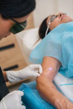 Doctor performing laser treatment on patient&acirc;s arm
