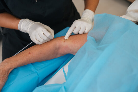 Healthcare provider inserting intravenous catheter into patient arm