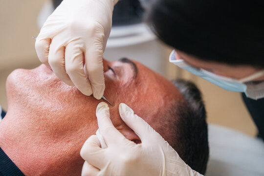 Man receiving professional facial skincare treatment at clinic
