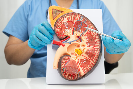 Chronic kidney disease, doctor with model for treatment urinary system, urology, Estimated glomerular filtration rate eGFR.