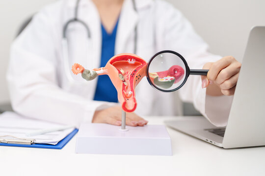 Doctor with Uterus and Ovaries anatomy model. Ovarian and Cervical cancer, Cervix disorder, Endometriosis, Hysterectomy, Uterine fibroids, Reproductive system, Pregnancy and health concept