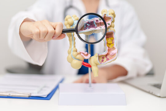 Doctor with human Colon anatomy model. Colonic disease, Large Intestine, Colorectal cancer, Ulcerative colitis, Diverticulitis, Irritable bowel syndrome, Digestive system and Healthcare concept