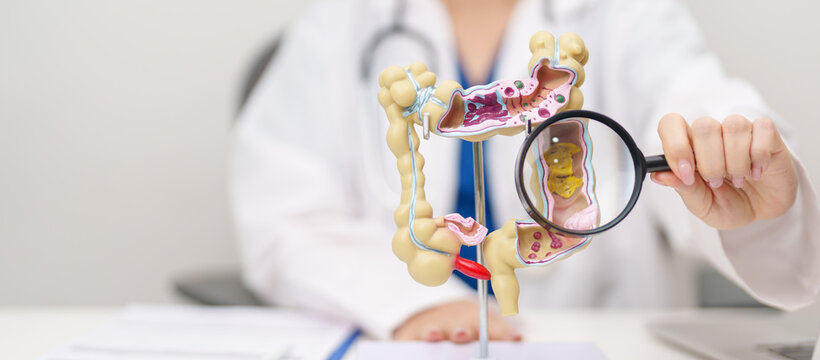 Doctor with human Colon anatomy model. Colonic disease, Large Intestine, Colorectal cancer, Ulcerative colitis, Diverticulitis, Irritable bowel syndrome, Digestive system and Healthcare concept