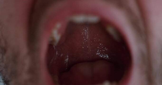 Extreme close-up of a man with mouth open, showing throat and oral cavity. Concept of medical examination, dental check, sore throat, infection, and healthcare diagnostics.