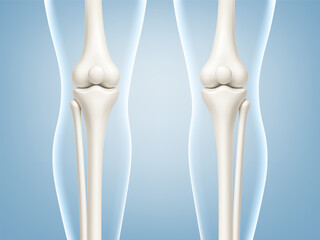 Anatomical models of human knee joints showing straight. Knee joint bones in the transparent human body. Medical or healthcare concept. Vector illustration