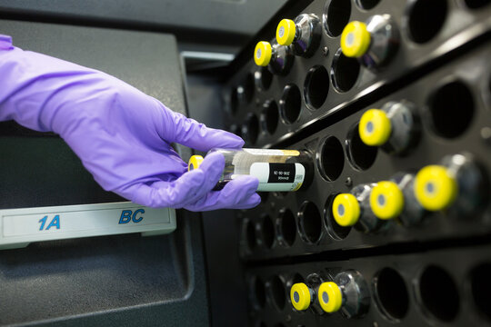 Check of microbial contamination