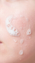 Fototapeta premium Foam cleanser applied on face with bubbles visible on skin. Close-up shot showing cleansing action. Concept of skincare, beauty treatments, personal care