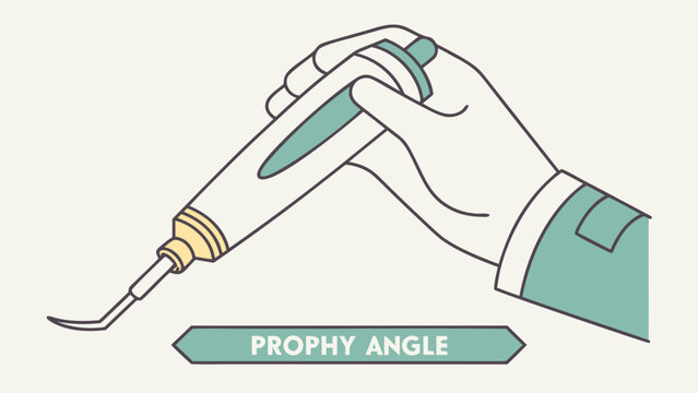A hand holding a dental prophy angle tool for cleaning teeth