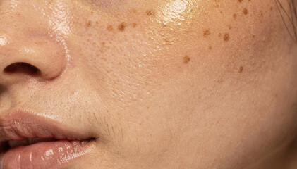 Close-up of Natural Skin Texture with Freckles and a Healthy Glow