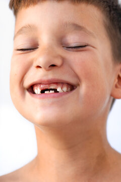 Boy With Missing Teeth Shows Joyful Smile