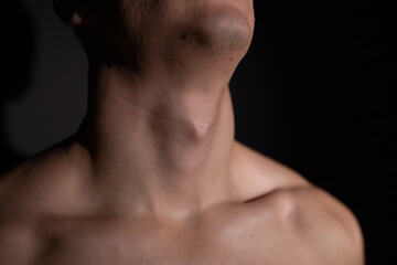 Naklejka premium young man's neck, adam's apple close-up. Concept: thyroid problems, sore throat from seasonal colds and viral infection