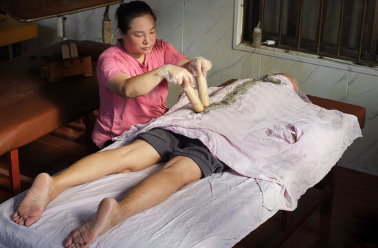 Moxibustion therapist is giving an Asian man a moxibustion treatment