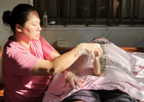 Moxibustion therapist is giving an Asian man a moxibustion treatment