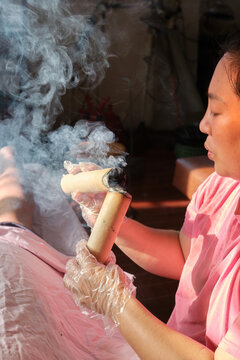 Moxibustion therapist is lighting and igniting a moxa stick.