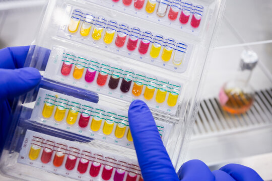 A scientist points the index finger of his gloved hand at a colored section of a rapid test for human blood.