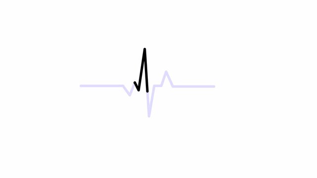 Minimalist heartbeat line animation on white background, medical healthcare concept, dynamic ekg pulse motion graphic clip