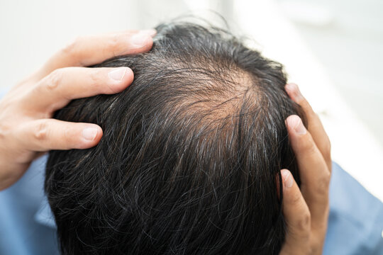 Bald in the middle head and begin no loss hair glabrous of mature Asian business smart active office man.