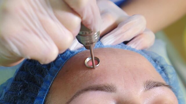 Professional dermatologist in medical gloves doing facial skincare procedure in beauty salon. Woman getting hardware cleaning and polishing sensitive skin. moisturizing and rejuvenating. 4 k video