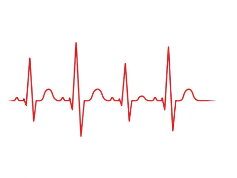A detailed electrocardiogram (ecg) waveform depiction isolated on white background