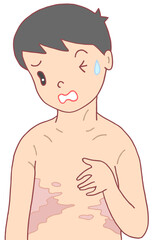 疾患・疾病のイラスト - 帯状疱疹・帯状ヘルペス・赤班