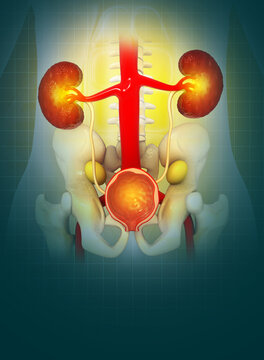Prostate disease, Benign prostatic hyperplasia (BPH), Prostate cancer. 3d illustration