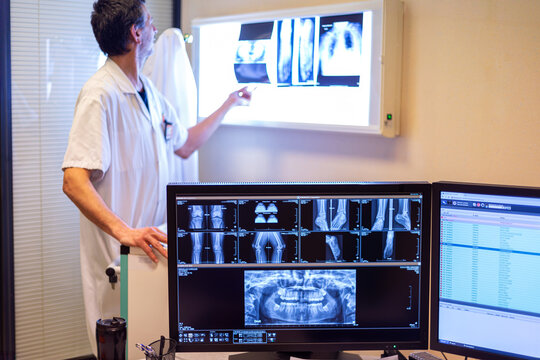 M&eacute;decin radiologue devant n&eacute;gatoscope avec radiographies et &eacute;cran de travail d'imagerie m&eacute;dicale