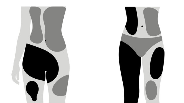 Human Body Fat Distribution Diagram Illustration.