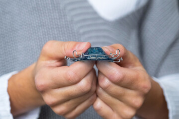 Girl holds blue orthodontic plate, demonstrating pediatric dental appliance for bite correction. © Ольга Симонова