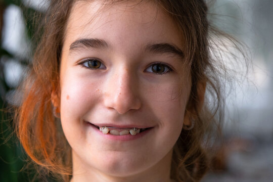 Girl aged 9 after orthodontic appliance treatment, healthy smile and aligned teeth, pediatric dentistry.