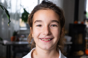 Fototapeta premium Portrait of a child with confident smile, orthodontic plate use for pediatric health and teeth correction.