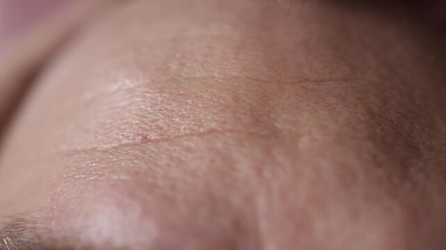 Closeup shows soft forehead wrinkles and natural skin texture highlighting early fine lines and subtle aging signs visible clearly in macro when the skin relaxes under neutral lighting