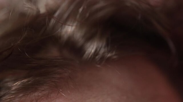 Dandruff on the hair visible in a closeup as fingers lift the strands showing dry flakes on the scalp a common issue linked to dryness irritation or improper hair care routines