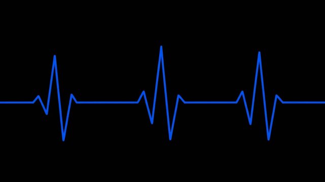 A medical illustration presents a vibrant blue electrocardiogram (ECG) line against a black backdrop, depicting a heartbeat