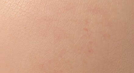 Fototapeta premium Close up macro view of healthy human skin showing pores and fine lines