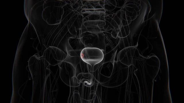 Close up of Bladder Cancer indication in Female X-ray HD Video | Bladder Cancer indication X-ray HD