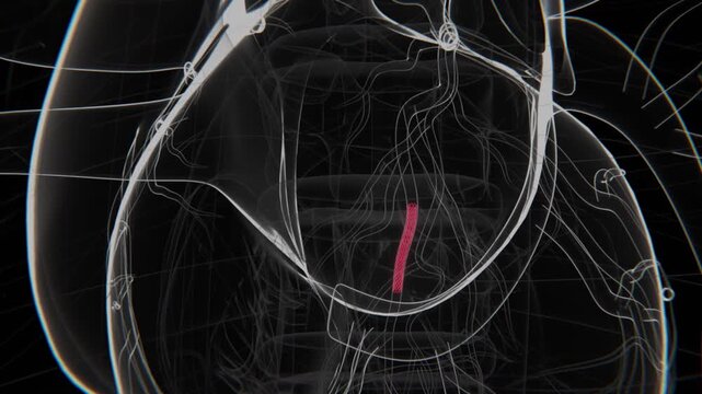3D Medical Illustration Of Coronary Stent Placement | Coronary Stent Video | Artery Stent Video | Xray Video in HD