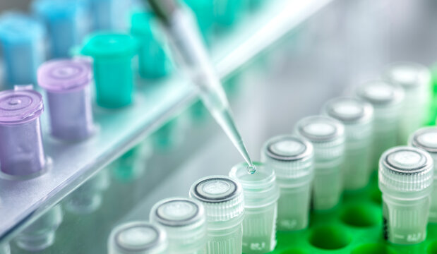 DNA sample pipetting in biotechnology laboratory for clinical research