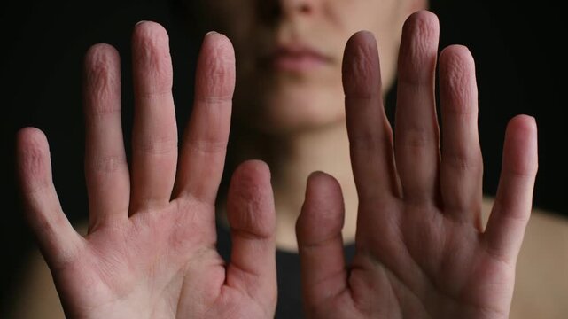 Detail shot woman hands showing wrinkled, pruney skin on fingertips, physiological response prolonged water exposure, with her face blurred in background. Pruney wrinkled fingers from water immersion