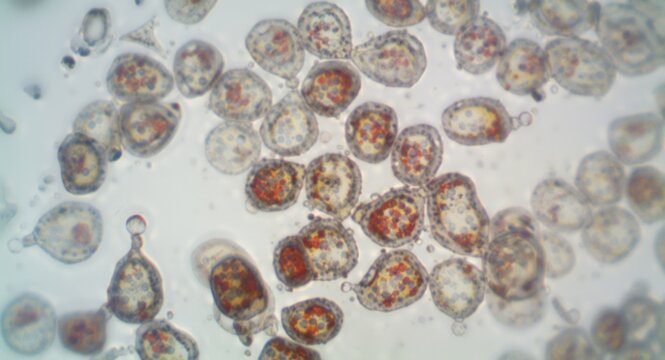 Examination of HEK 293 cell growth in DMEM to study receptor signaling and protein synthesis relevant to cancer research