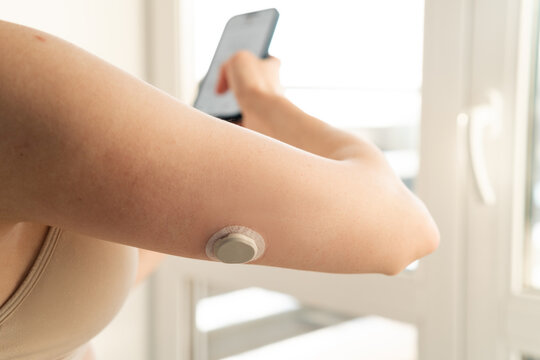 Close-up side view of a woman with a continuous glucose monitor sensor on her arm checking her blood sugar levels on a smartphone app