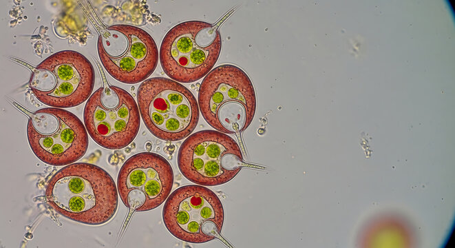 Microscopic View of Pond Algae Trachelomonas dangeardi Captured at High Magnification Showing Intricate Cell Structure and Organic Detail in Freshwater Sample via Scientific Laboratory Equipment