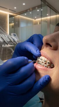 Orthodontist adjusting metal braces on a patient's teeth in a modern dental clinic.