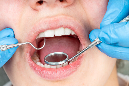 Close-up of dentist examining patient teeth with dental mirror and probe for oral health