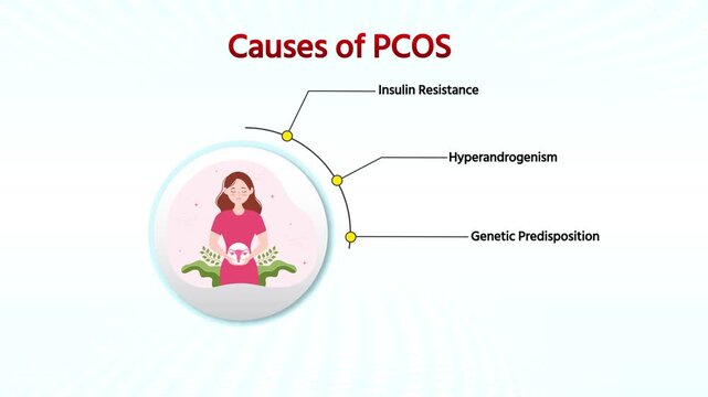 Causes of PCOS &ndash; Hormonal Imbalance and Ovarian Disorder Medical Animation