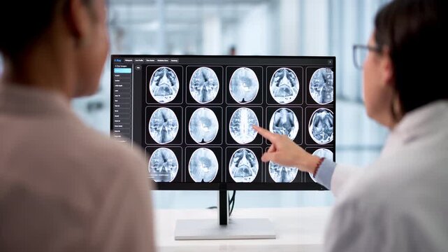Medical Doctor Looking At MRI Brain Scan