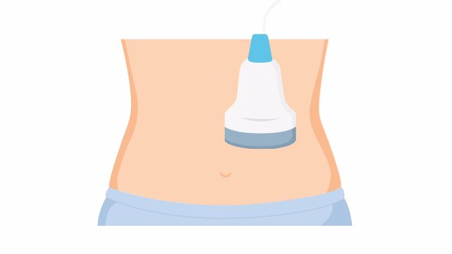 Flat 2D vector illustration of abdominal ultrasound scan, medical USG examination concept for healthcare animation and diagnostic motion graphic.