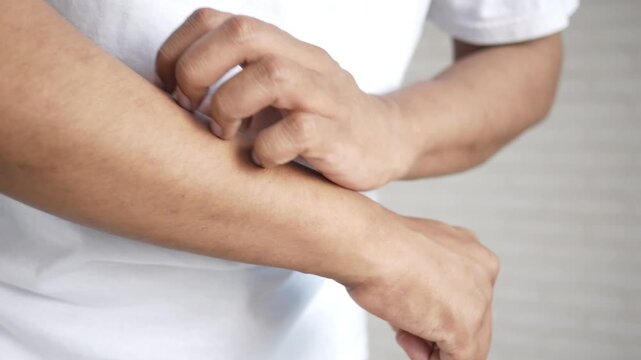 Close up shot of man scratching his forearm skin due to allergy or irritation in slow motion
