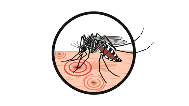 Close-up illustration of a mosquito biting human skin with red inflamed circles showing the site of the insect bite and irritation.
