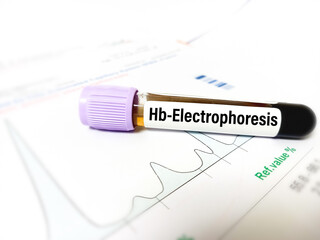 Obraz premium Hemoglobin electrophoresis report with blood sample. Blood sample for Hb-electrophoresis test.