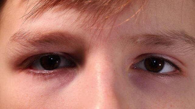Close-up of a child's eyes and eyebrows, boy blinking and staring at the lens.